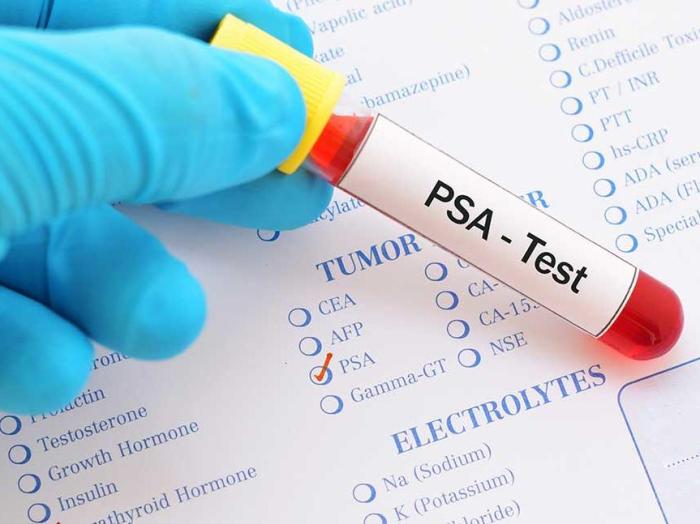 Psa is an abbreviation that stands for -specific antigen.